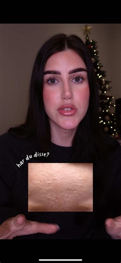 Clogged Pores: Effective Solutions and Tips