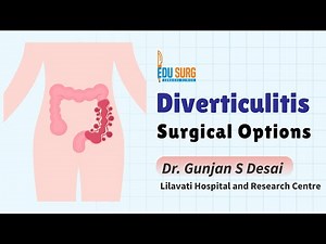 Diverticulitis Part 5 Surgical Management and NEET PG Rapid Revision