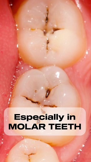 Maximize Dental Health with Oral-B Electric Toothbrush