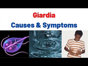 Giardiasis (Fatty Stool) Symptoms,Causes, Treatment, Summary: What is Giardia? Giardia lamblia