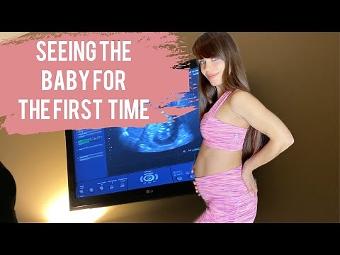 Pregnancy Update And Ultrasound At 11 Weeks + Genetic Testing