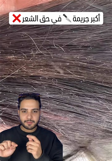 الخطأ الذي تقوم به 90% من الفتيات في العناية بالشعر هو تعريضه الشعر المستمر للحرارة بدون وقاية و هذا قد يدمر الشعر و ينتج عنه عواقب وخيمة #algeria #skincare #haircar