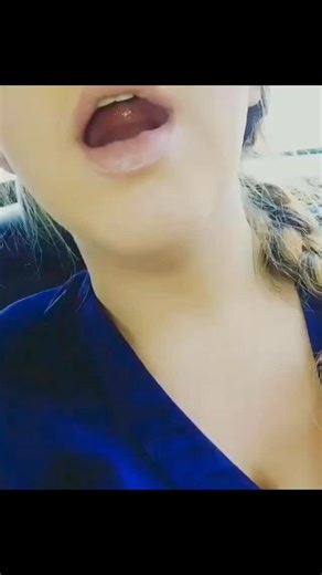 74K views · 8 comments | Rare case of hyper-mobility of the tongue!...