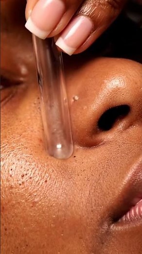 Nose Blackhead Extraction — Close Up