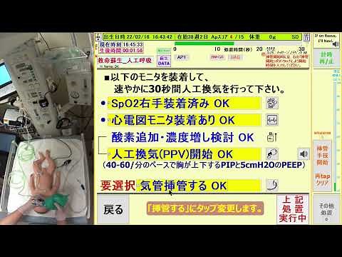 新生児蘇生（NCPR）意思決定支援システムをシミュレーション蘇生に使ってみた！