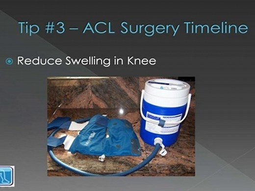 ACL Surgery Recovery Timeline Video - 7 Quick Tips