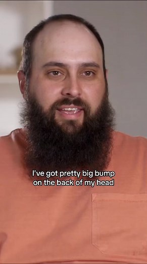 Big Bump on Head - Causes, Removal, and Treatment