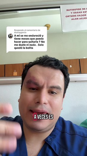 Cómo tratar el chalazión en los párpados
