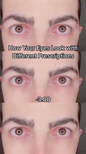 Your glasses are changing how your eyes look