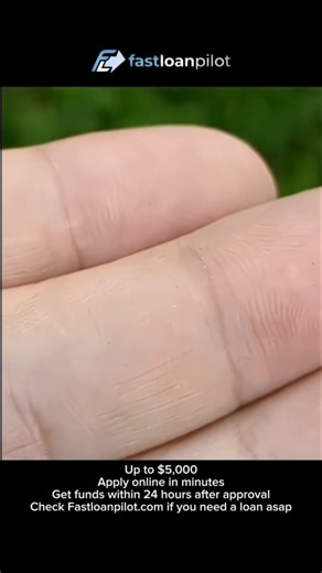 Trendingsociety | The Golden Tortoise Beetle (Aspidimorpha sanctaecrucis) is a striking insect native to regions of Asia, including India, China, and parts... | Instagram