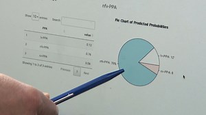 New online tool to diagnose dementia