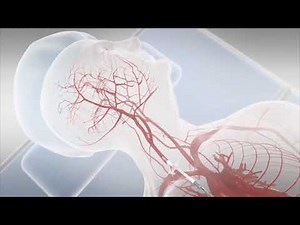 HealthTalks - Baptist Health Louisville: Preventing Stroke Using TCAR