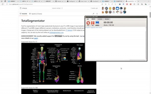 从代码中 讲解如何使用 Totalsegmentor 进行 MRI 自动分割