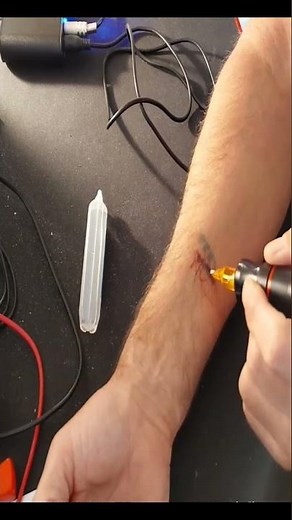 tattoo removal with saline solution short