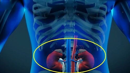 3D动画演示人体肾脏移植手术全过程，现代医学技术真是发达