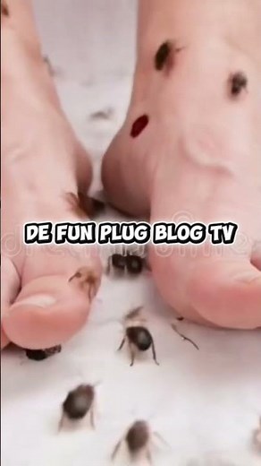 Unveiling the Reality: Bed Bugs Infestation on Skin #BedBugs #InfestationAwareness #pestcontrol