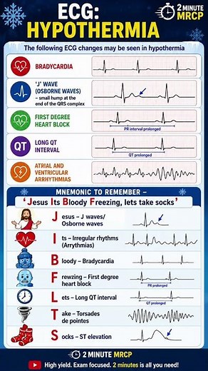 ECG Hypothermia Mnemonic You’ll Never Forget! | MRCP Shorts