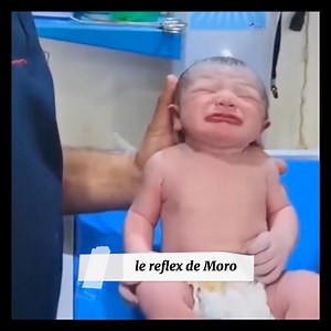 8.1K views · 91 reactions | ⚠️ Le réflexe de Moro est un réflexe normal chez les nourrissons, qui est déclenché par un changement soudain de la position du corps ou par un bruit fort.  Il se caractérise par une extension des membres suivie d'une flexion rapide. Ce réflexe disparaît généralement vers l'âge de 4 à 6 mois. | ويجمعنا الطب - La médecine nous rassemble | Facebook