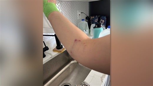 Maryland dog attack caught on camera, victim claims police never responded