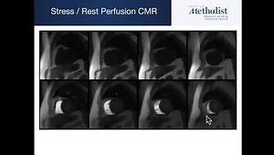 Cardiac MRI: The Ultimate Diagnostic Tool?