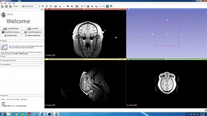 1. 3D Slicer - Introduction to 3D Slicer