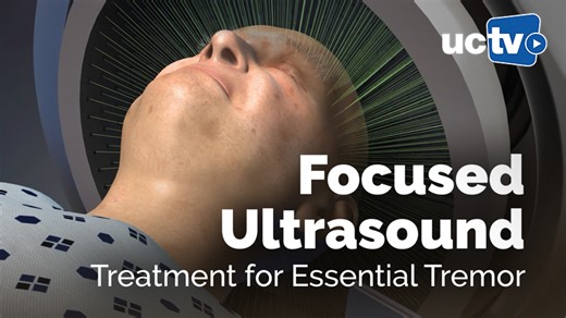 VIDEO: Focused Ultrasound Treatment for Essential Tremor