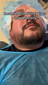 Steel Grey is a very popular color. It’s an easy 3-day trip to our office for the ColorEyes procedure. More procedure information at MyColorEyes.com #coloreyes #eyecolor #keratopigmentation #eyecolorchange #flaak | "Dr. Brian" Boxer Wachler, MD