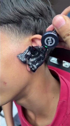 The removal of the blackhead from the ear😳✂️#fyp #foryou #foryoupage #viral #explore #comedy #asmr