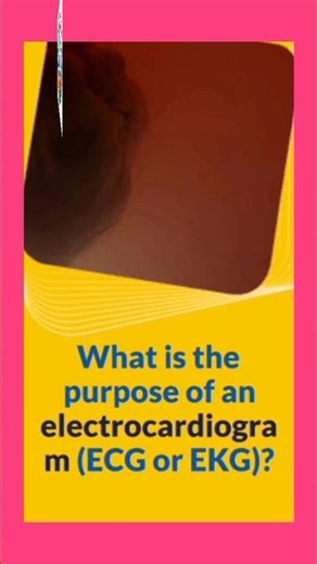 What is the purpose of an Electrocardiogram (ECG or EKG). #shorts