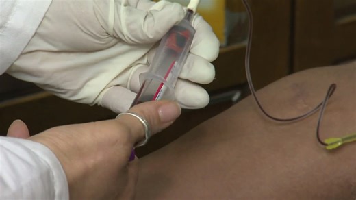 AHA, ACC update cholesterol guidelines, emphasize early prevention and healthy lifestyle