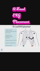 🫀🩺12 Lead EKG placement #nursing#nursingschool #nursingstudent #nurse #nursinglife #nursingstudents #nursingnotes #nursingnote #nclex#nursingexams #nursingeducation#clinical#bsn #rn#nurseofinstagram #ekg #12lead | Professormollie