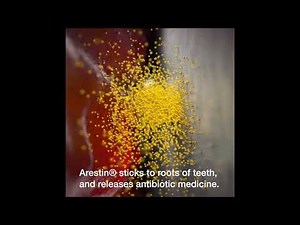 ARESTIN VIDEO - RESSLER DENTAL