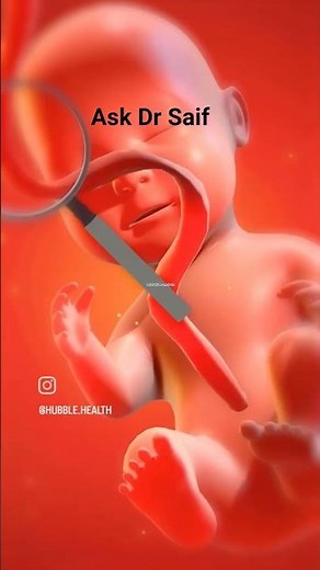 The 5 Key Pregnancy Scans: When They Happen & What They Check For (Don't Miss These!) ASK DR SAIF