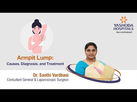 Armpit Lump: Causes, Diagnosis, and Treatment | Yashoda Hospitals Hyderabad