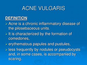 ACNE VULGARIS - SlideServe