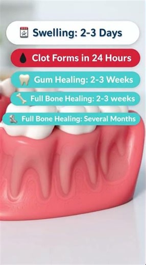🦷 Getting Multiple Teeth Removed? Here’s What Recovery Looks Like
