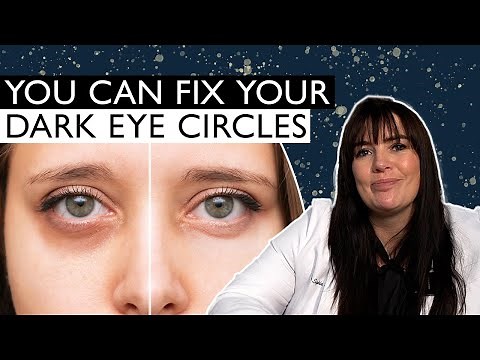 What is an Under-Eye Fat Transfer?