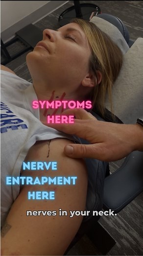 Did you know that adhesion doesn’t have to be close to your symptoms to cause symptoms? The large bundle of nerves that leave the side of your neck and go into your armpit are commonly entrapped when patients come in with neck symptoms. That means anytime the shoulder is engaged, those nerve roots pull tight and irritate the discs next to them. When you remove the adhesion, the nerves are free to move and there is far less irritation on the nerve roots. How do we fix it? With our hands, a hand t