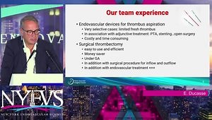 Open Thrombectomy: Is There a Role, When and Why?