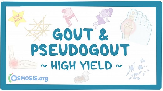 Gout and pseudogout: Pathology review: Video, Causes, & Meaning | Osmosis