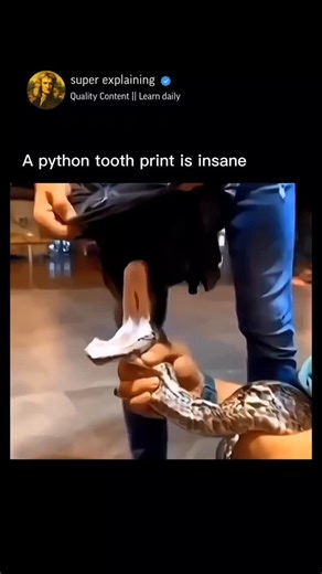 Super Explaining on Instagram: "Pythons may not possess venom, but their power lies in precision and pressure. These massive constrictors use rows of sharp, backward-curved teeth to grip their prey firmly before wrapping their muscular coils to suffocate it. Their bite often leaves behind distinctive, crescent-shaped tooth marks — a reminder of nature’s intricate design for survival and dominance. #pythonfacts #wildlife #nature #reptiles #animalbehavior #discovery #science #knowledge #wildlifewo