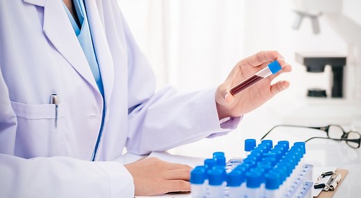 Leucocitos Altos en Sangre. Qué Significa en Análisis de Sangre - AEDN