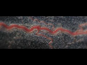 Red blood cells flow in blood vessels