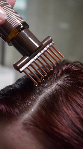 Hair Infusion je serum sa 6 ljekovitih ulja i vitaminima A, D i E, pažljivo biranim za njegu tjemena i dužine kose. Namijenjen je njezi svih tipova kose a evo koje efekte možeš očekivati: ✅Jača korijen i hrani kosu. ✅Intenzivno je hidrira. ✅Dubinski oporavlja oštećenu, suvu, blajhanu kosu. #hairinfusion #serumzakosu #zdravakosa #oporavljenakosa #sjajnakosa #rossen | Rossen kozmetika