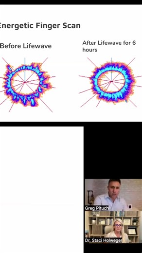 Explore the fascinating world of meridian systems and how they impact your health. We reveal insights from a Biowell scan before and after using LifeWave patches to highlight energy shifts and wellbeing. Discover the power of your body's energy network! #MeridianSystems #EnergyHealing #LifeWave #WellnessJourney #BiowellScan #HealthInsights #HolisticHealth #NaturalHealing #BodyEnergy #SelfCare | Dr. Staci Holweger Regenerative Medicine