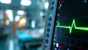 ICU Patient Monitor in Critical Care Unit Stock Footage - Video of medical, oxygen: 352759270
