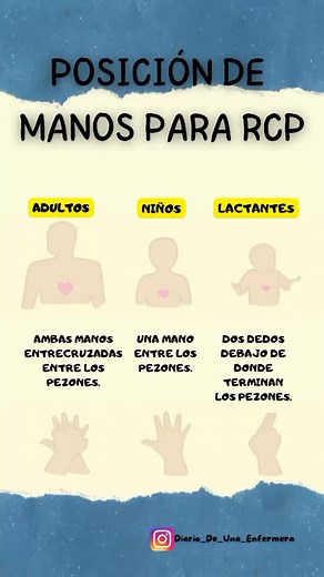 Maniobra en Mano de Enfermera: RCP Básico y Avanzado
