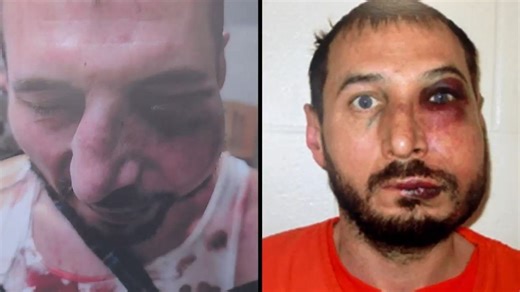 Lawmakers to question safety chief over excessive force lawsuits against state police