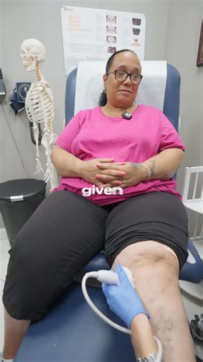 Cortisone (steroid) injections are a common treatment for knee arthritis and inflammation. They deliver medication directly into the joint to calm swelling, relieve pain, and improve mobility. However, these injections can’t be done too often — overuse may damage the joint. For many patients, cortisone offers temporary relief that allows them to stay active and continue physical therapy. When arthritis becomes severe and injections no longer help, a knee replacement surgery may be the best optio