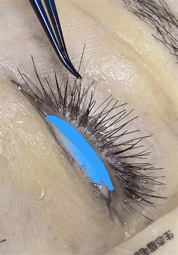 Eyebrow and Eyelash Transplant Procedures Explained